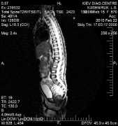 Spinal cord CAT scan 3